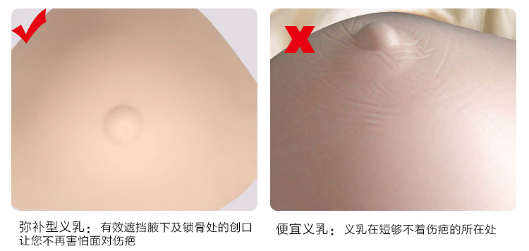 2016梅州蒂億曼热销硅胶义乳厂家加盟供应批发