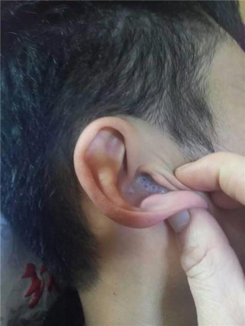 声誉好的洗眼睛当选润林足道 中国采耳朵