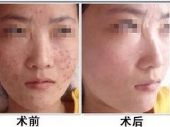 哪里較有超值的西安cczl_西安cczl