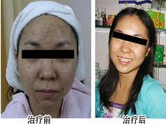 實惠的西安bhzl推薦_bhzl方法