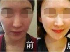 長寧美容整形培訓，哪里有{yl}的美容整形培訓機構
