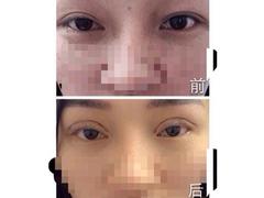 資深的注射美容整形培訓，您的bezs 可靠的注射美容整形培訓
