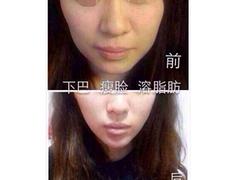 資深的注射美容整形培訓，您的bezs 可靠的注射美容整形培訓
