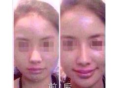 哪兒有周到的注射美容整形培訓_閔行注射美容整形培訓