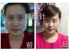 寶山微創整形培訓：想找qw的微創整形培訓就來妃美