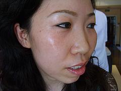 四川祛rsw，成都服務好的qb痕在哪里