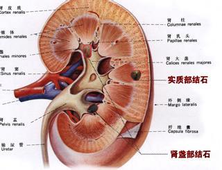 哪里有提供放心的泌尿系结石：德州泌尿系结石