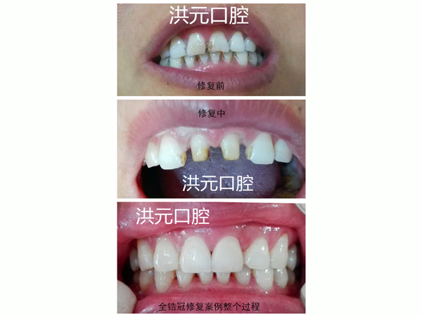 泰安牙科診所哪家專業/值得信賴的牙科診所