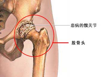 中國髖關(guān)節(jié)扭傷zl，哪里有提供資深的髖關(guān)節(jié)扭傷zl