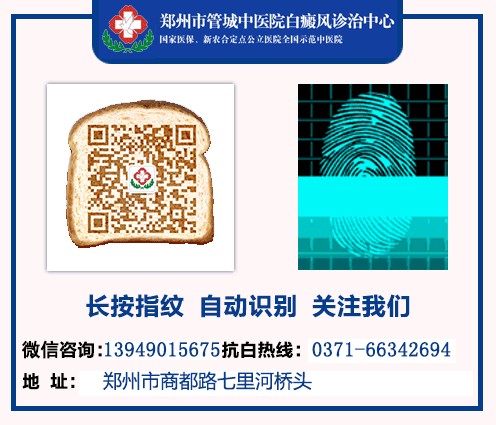 河南哪家醫(yī)院zl白癜風(fēng)效果好