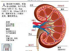 腎結石哪家成功率高：福建專業腎結石zl