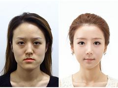 哪家提供劃算的美容，女士美容