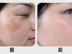 滄州美容|有口碑的美容公司推薦