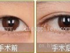 滄州美容|有口碑的美容公司推薦