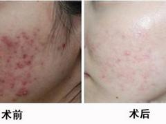 整形醫院效果怎么樣 廊坊哪家整形醫院規模大