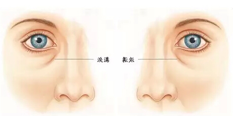 線雕培訓(xùn)---線雕綜合培訓(xùn)