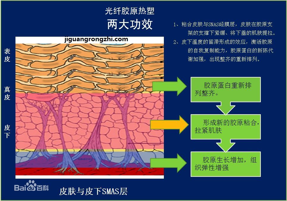 線雕培訓(xùn)學(xué)習(xí)