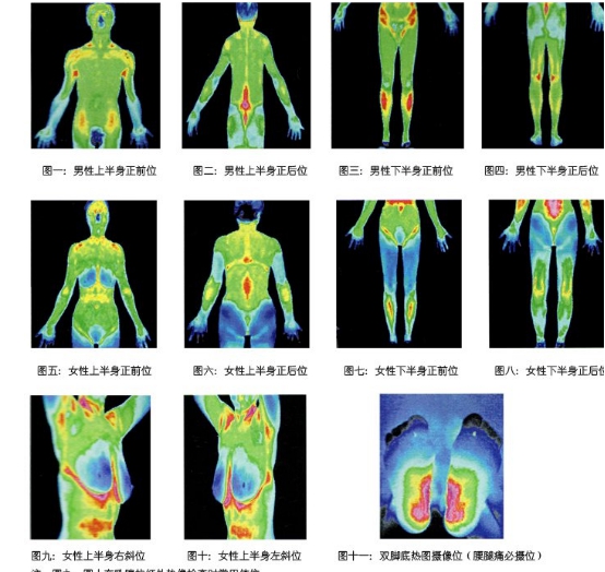 巢湖数字式医用红外热像仪