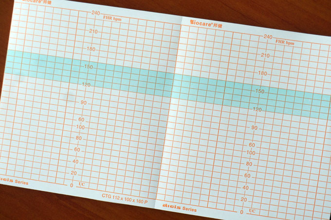 邁瑞心電圖紙：【熱銷】東莞價位合理的心電圖紙