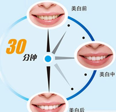 貴州納米炫齒浮雕技術(shù)培訓(xùn)