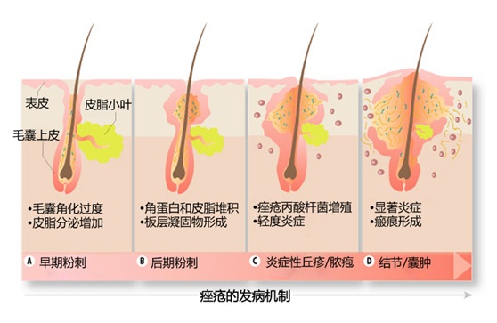 （重慶）（晶膚）注射抗色素針可以維持多久？