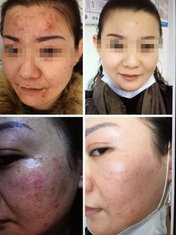 山東周到的皮膚病zl修復_青州cc修復