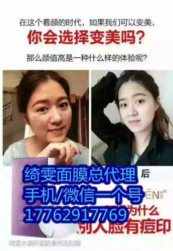 綺雯面膜代理