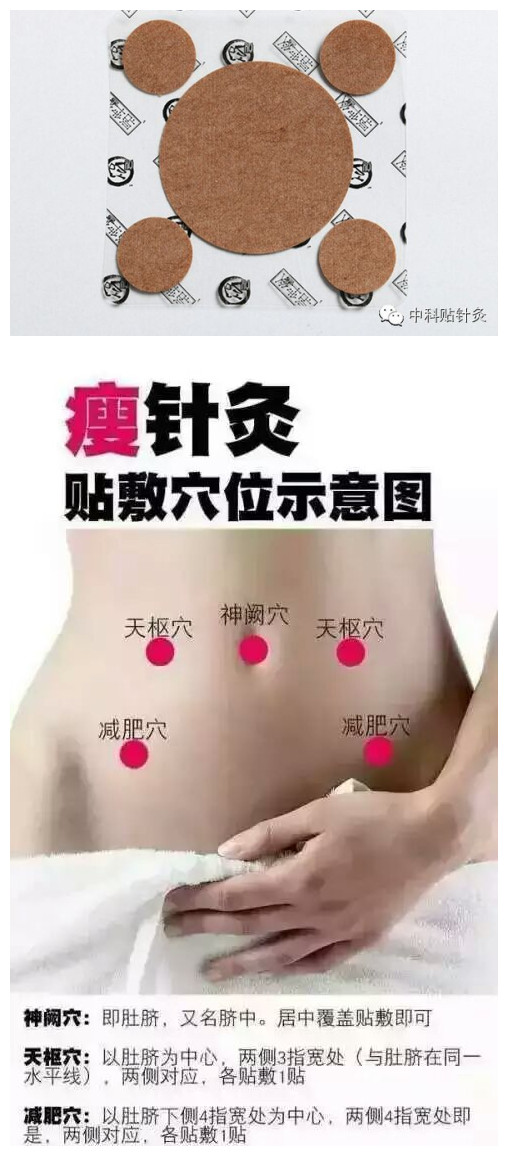 河北可靠的瘦針灸代理——天津瘦針灸