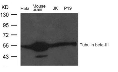 南京供應優質TUBB3 Antibody