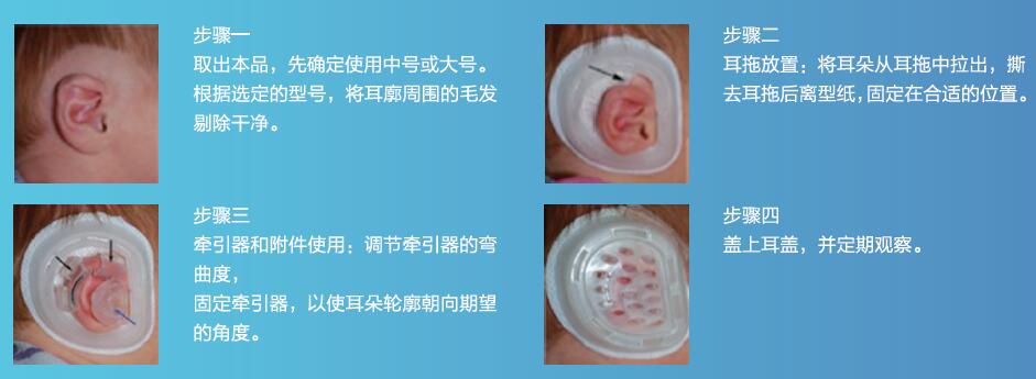重慶呼吸訓(xùn)練器_廈門劃算的深呼吸訓(xùn)練器在哪里